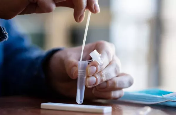 Las farmacias madrileñas reciben otros 1'4 millones de test de antígenos gratuitos